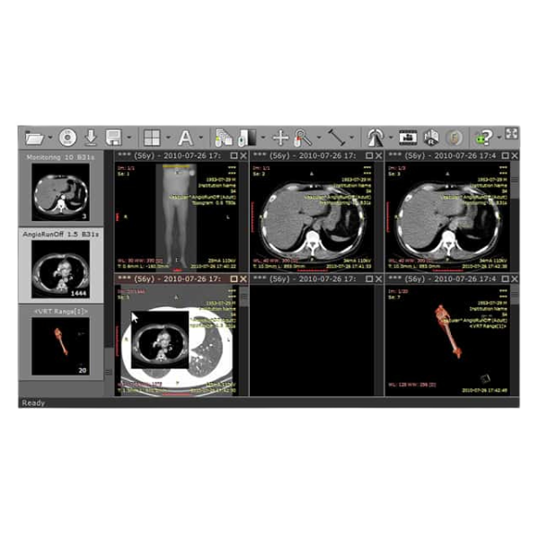 RadiAnt Dicom Viewer